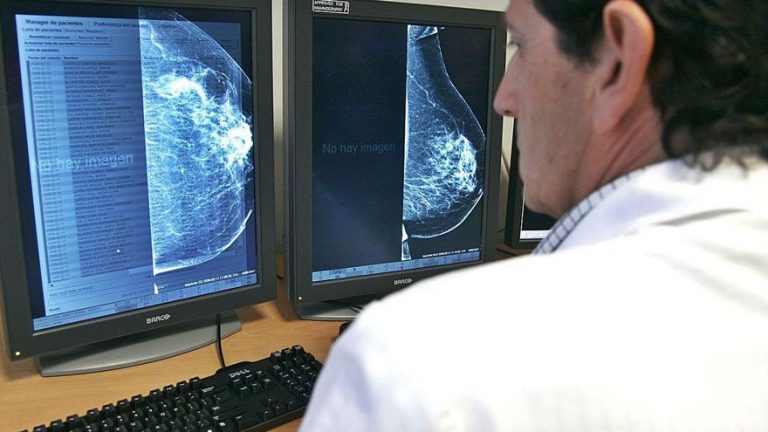 Una vía para ‘esquivar’ los efectos de la quimioterapia