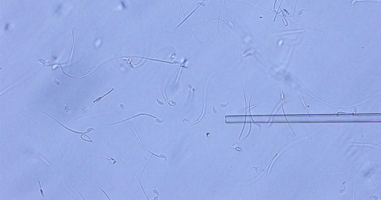 El esperma liofilizado de estos ratones ha permanecido intacto durante 6 años en el espacio