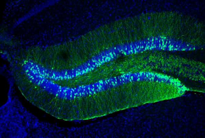 Identifican al Smad2, un gen implicado en la plasticidad del cerebro