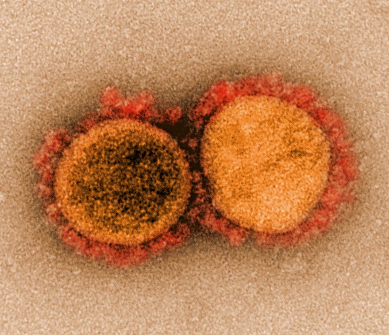 Los «secretos» de la variante Delta: es un «monstruo» al lado del coronavirus de Wuhan