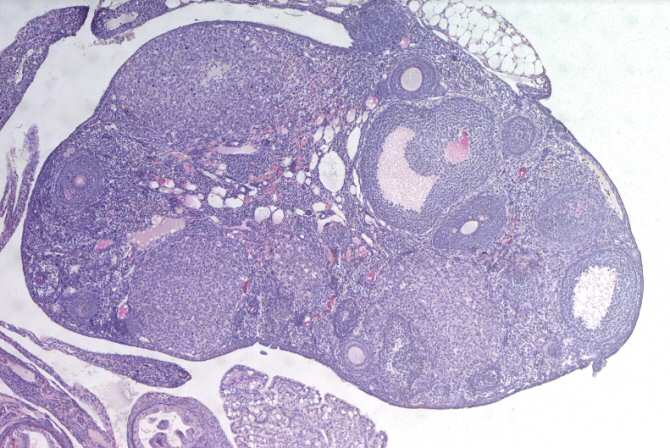 Genes relacionados con una vida reproductiva más larga en las mujeres