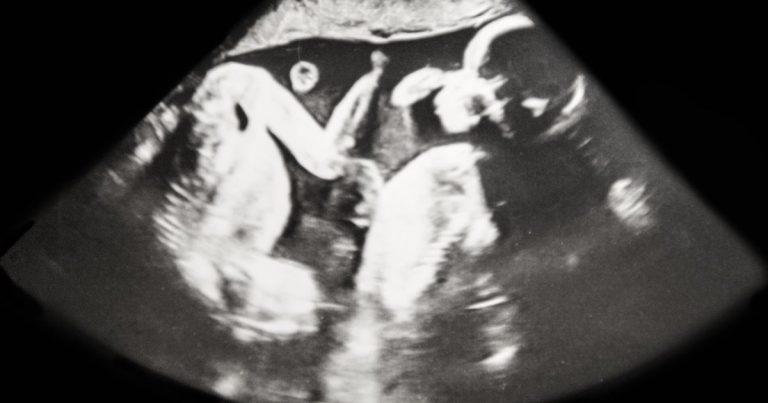 ¿Dónde está mi hermano gemelo?