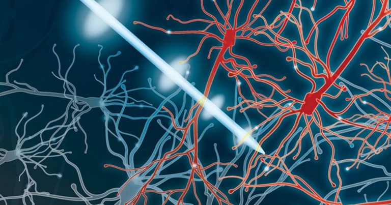 Estimulación cerebral profunda para tratar el Parkinson
