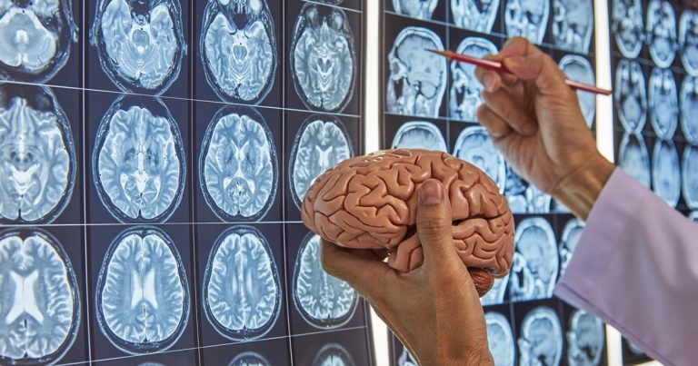 Así reacciona el cerebro ante las ofertas del Black Friday