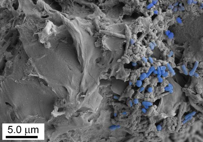 ¿La ingesta de microplásticos altera la microbiota intestinal?