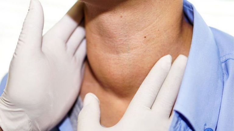 ¿Es un efecto secundario de la vacuna covid la aparición de bultos en el cuello y en las axilas?