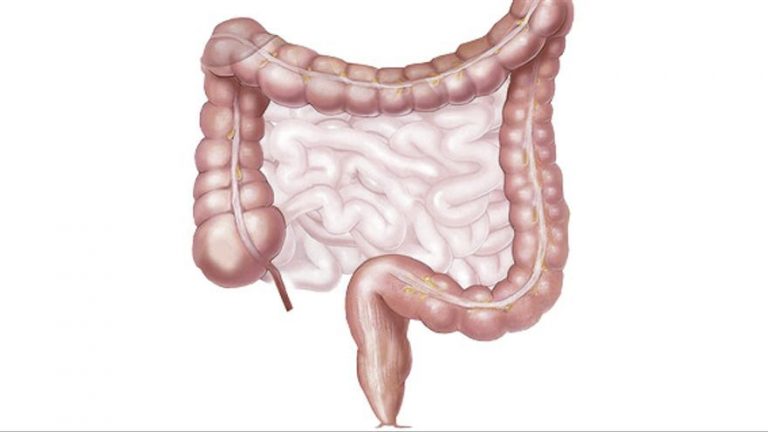 Inflamaciones intestinales, enfermedades del estilo de vida occidental