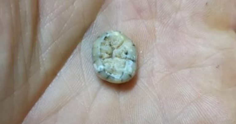 Hallan el extraño diente de una niña denisovana en Laos