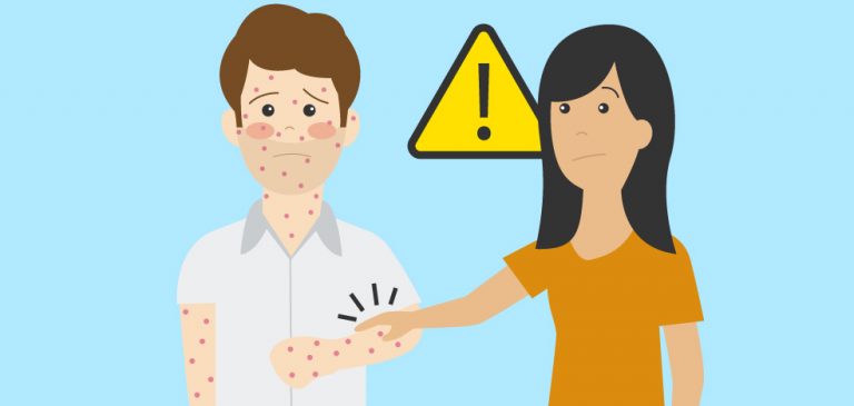 Guía visual de la viruela del mono: qué es y cómo se contagia