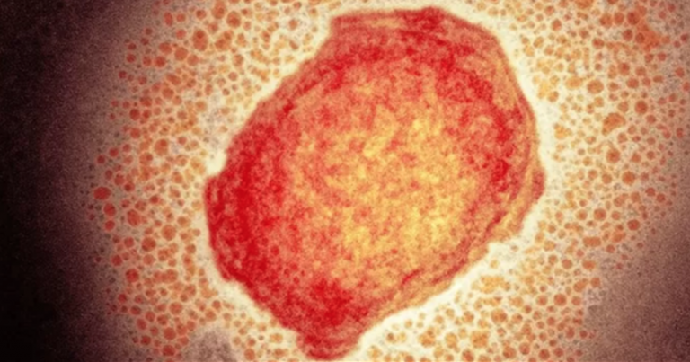 ¿Podría convertirse la viruela del mono en una nueva pandemia?