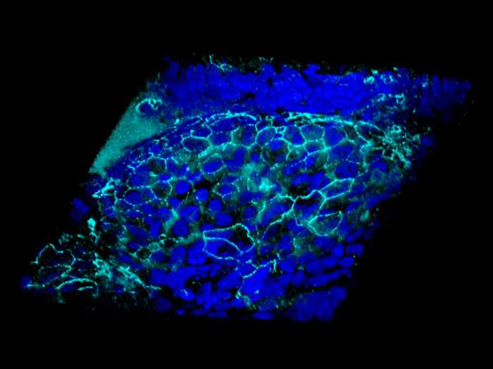 ¿Revertir de forma fácil los daños causados por la fibrosis quística?