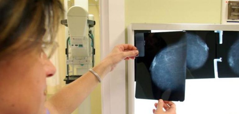 El cáncer de mama se expande durante la noche